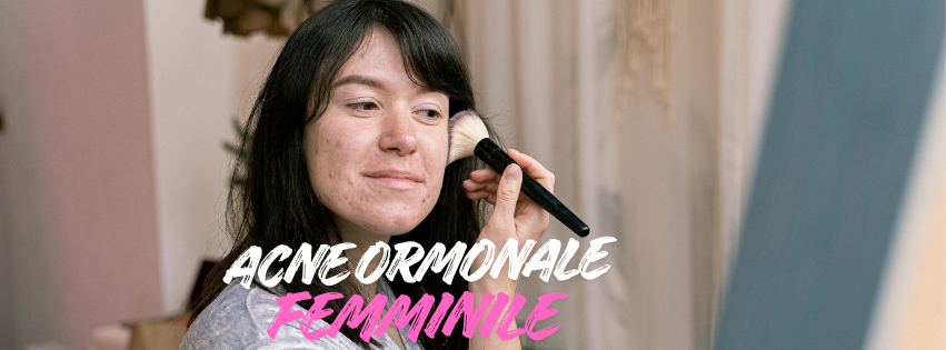 Acne ormonale femminile
